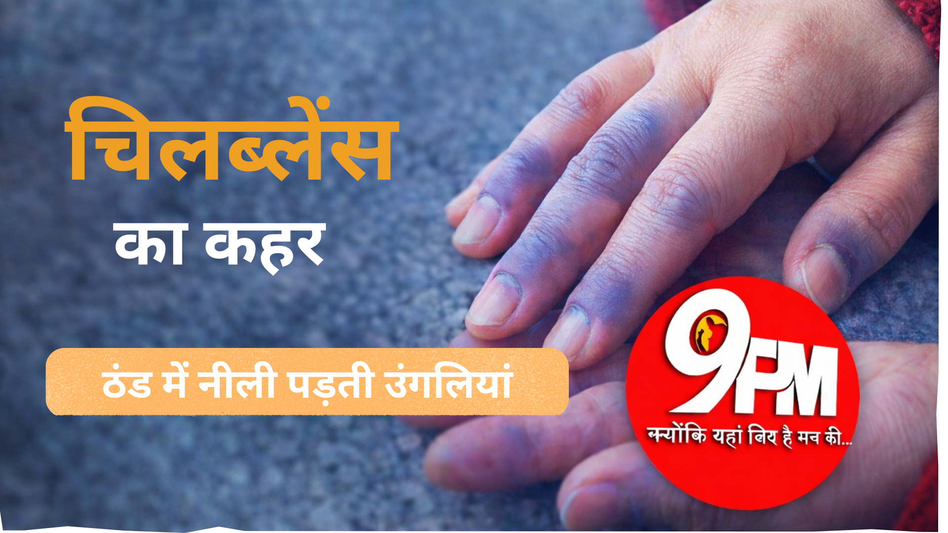चिलब्लेंस का कहर: ठंड में नीली पड़ती उंगलियां, महिलाओं में तेजी से बढ़ रहे मामले